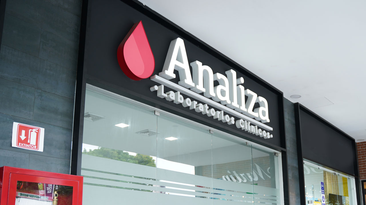 Analiza